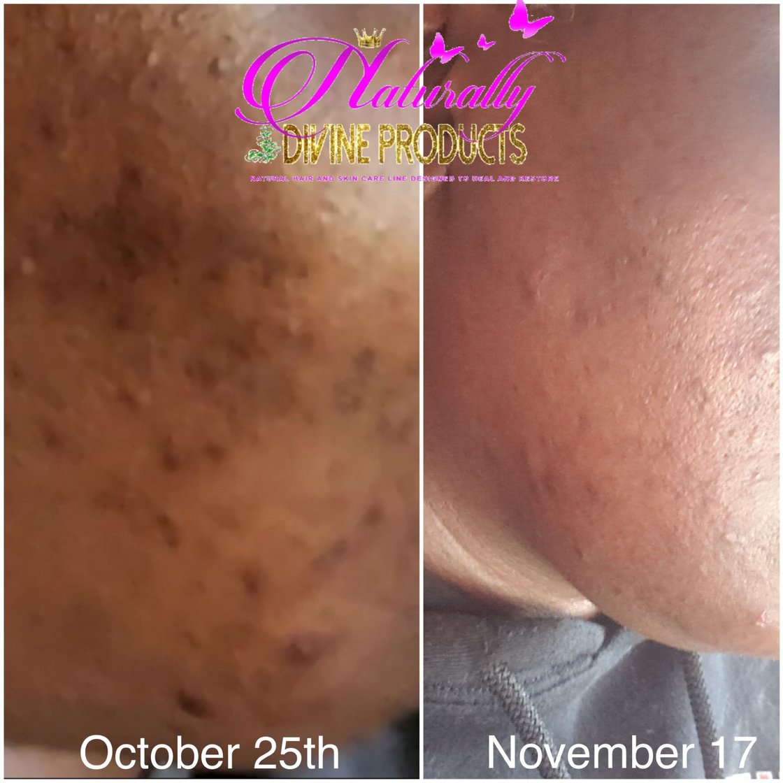 Image of Category: Facial Systems