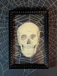 Image 1 of ANTIQUE ANATOMICAL COLLECTION - Preserved web  F
