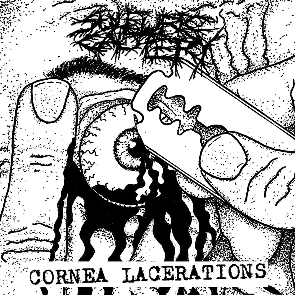 Image of Sulfuric Cautery - Cornea Lacerations 7"