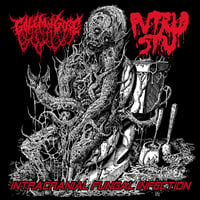 Golem of Gore / Putrid Stu -  Intracranial Fungal Infection - CD