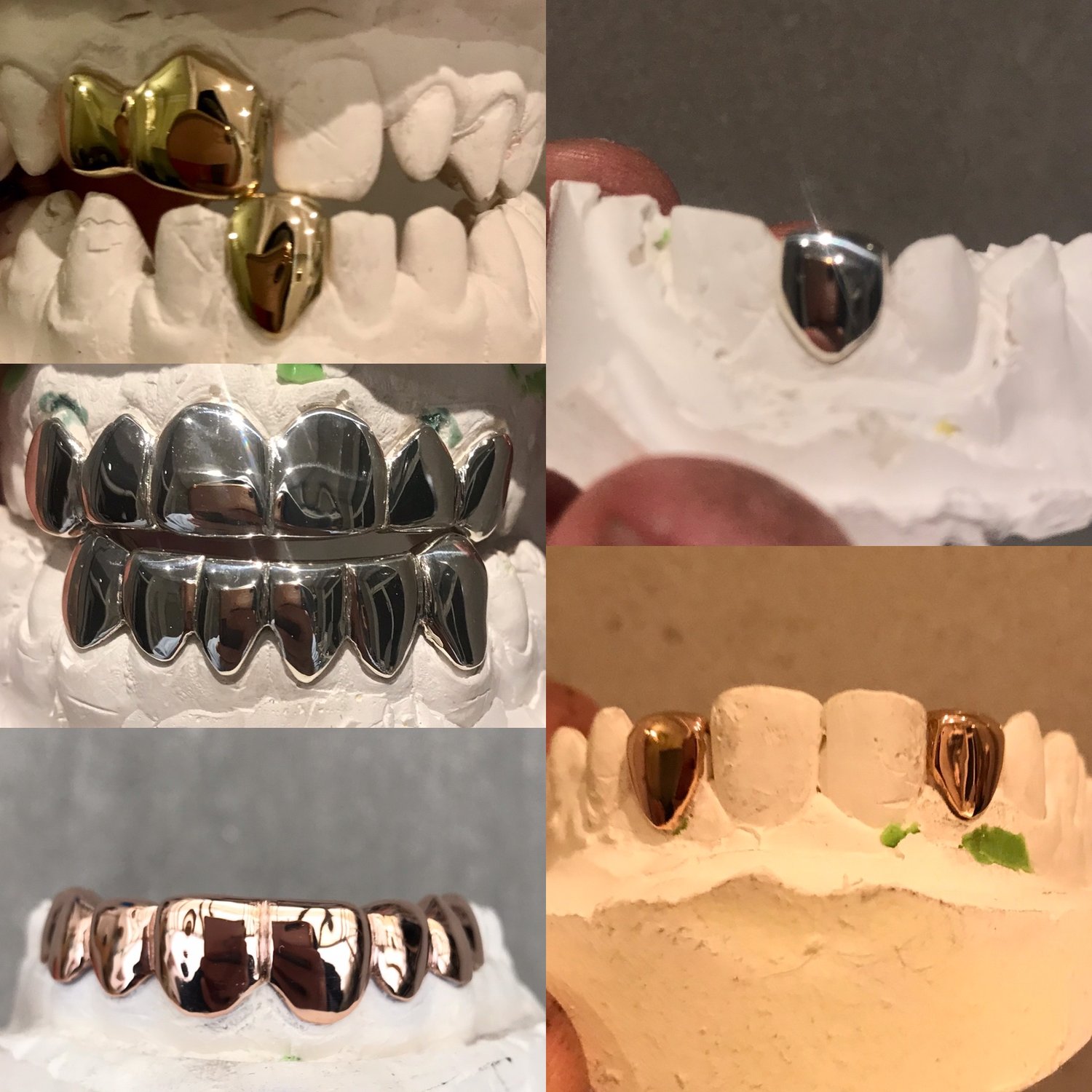 Image of Plain Grillz