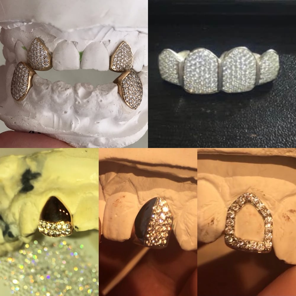 Image of DIAMOND GRILLZ