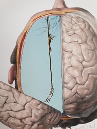 Image 3 of 'Demise'