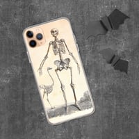 Image 2 of Antique Bookpage Detailed Anatomical Illustration Human and Bird Skeletons Clear Case for iPhone®