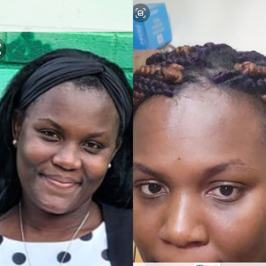 Image of Medicated soap