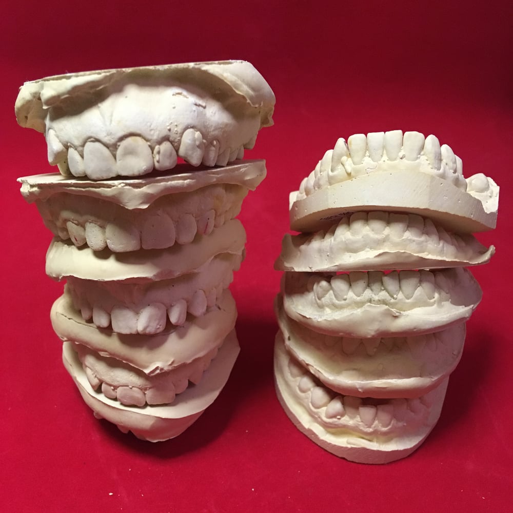Plaster Teeth Castings