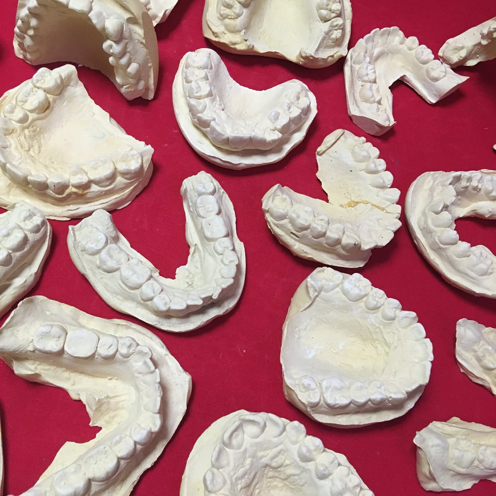 Plaster Teeth Castings