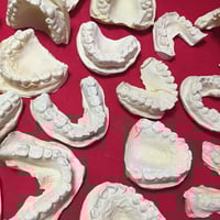 Image 2 of Plaster Teeth Castings