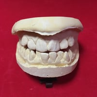 Image 1 of Plaster Teeth Castings