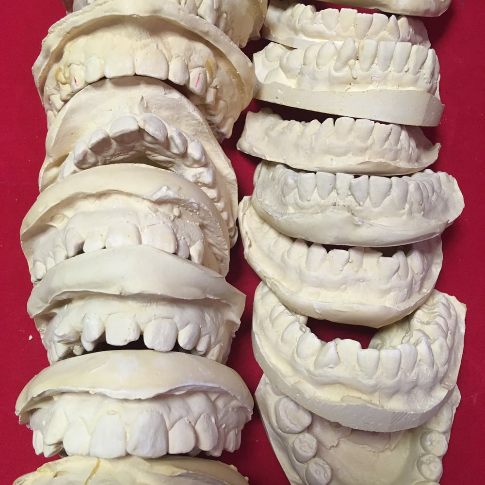 Plaster Teeth Castings