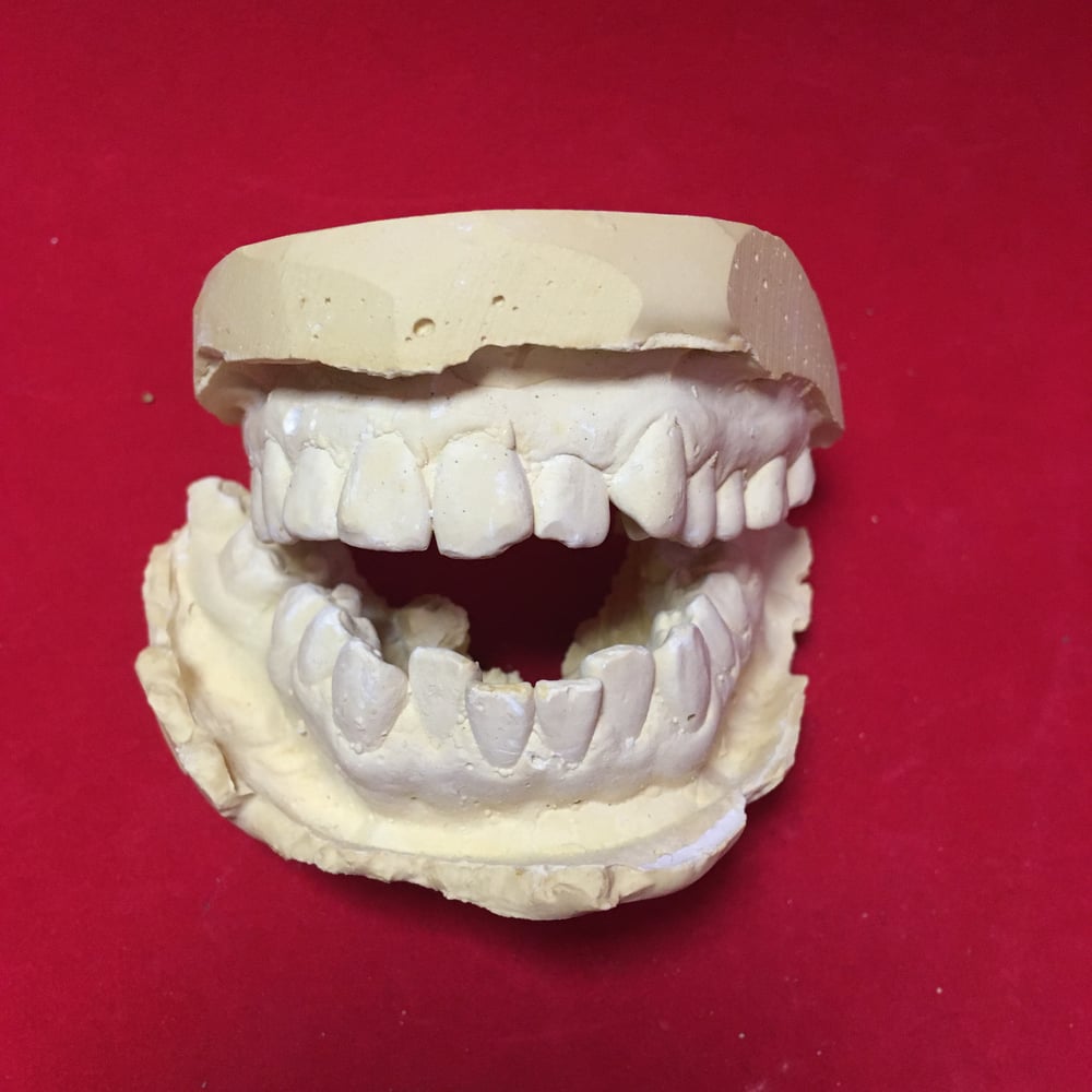 Plaster Teeth Castings