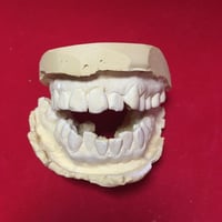 Image 5 of Plaster Teeth Castings