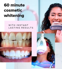 Teeth Whitening Kit