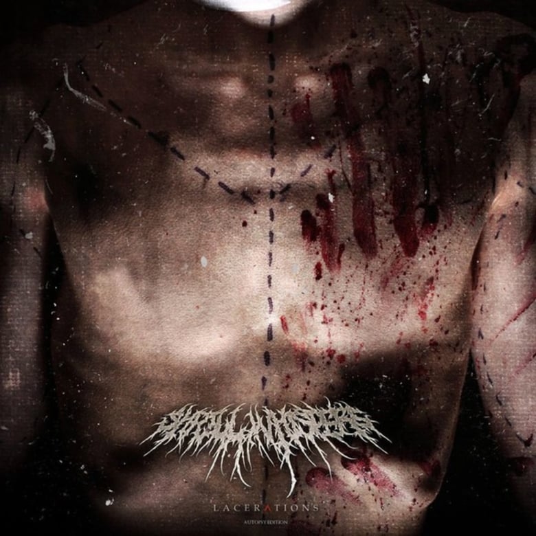 Image of Lacerations: Autopsy Edition CD