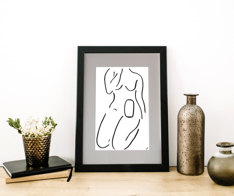 Female ostomate outline body print