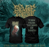 Image 1 of Severe Torture