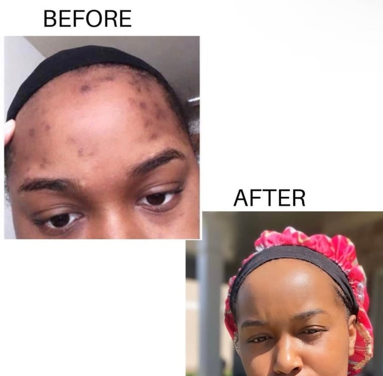 Curcuma , carrot & papaya facial soap  Image 4