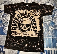 Broken Bones Never Say Die