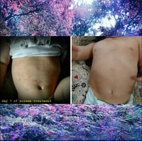 Image 2 of Lavender Bud Healing Cream for Eczema and Psoriasis