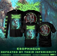 Image 1 of Esophagus (SS/LS)