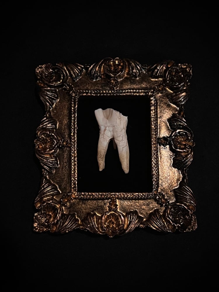Image of Framed Tooth 