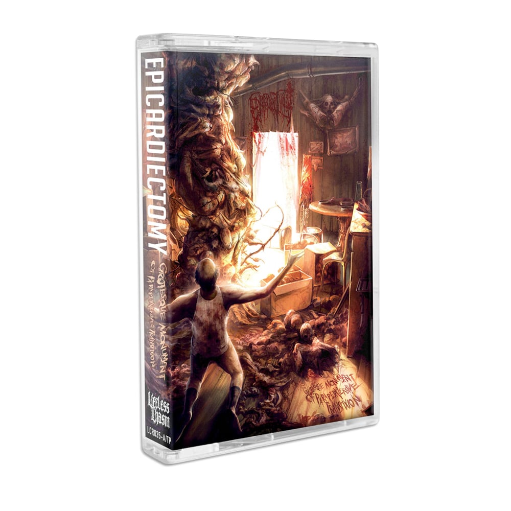 Image of EPICARDIECTOMY "GROTESQUE MONUMENT OF PARAPERVERSIVE TRANSFIXION" CASSETTE