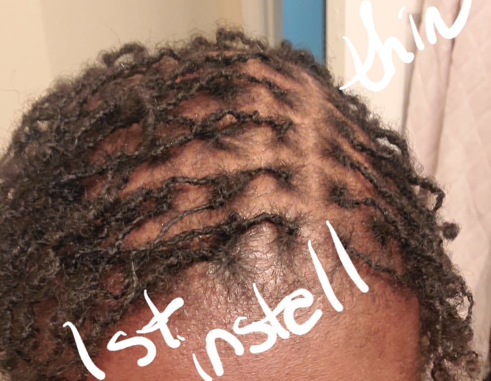 Image of Hair growth oil