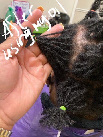 Image of Hair growth oil