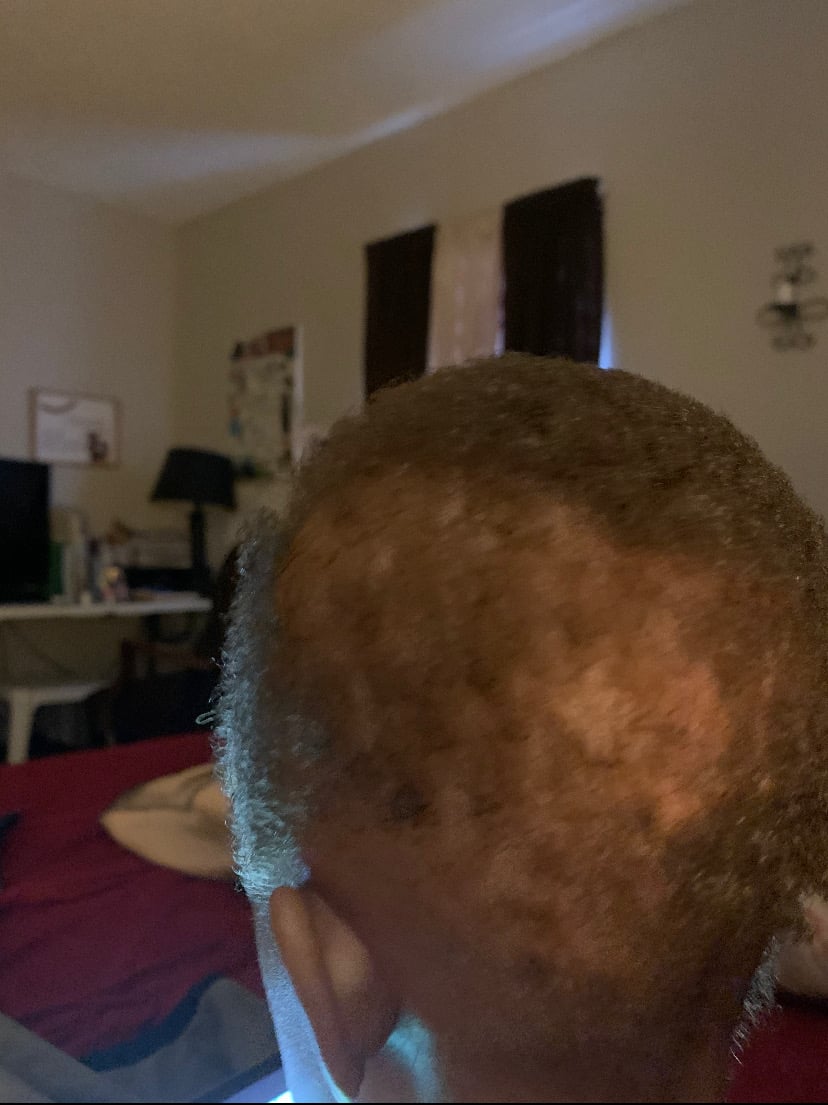 Image of Fenugreek Hair Growth Butter