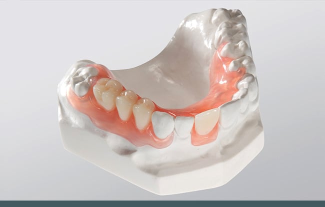 Lower Valplast Flexible partial | QualityDentalLab