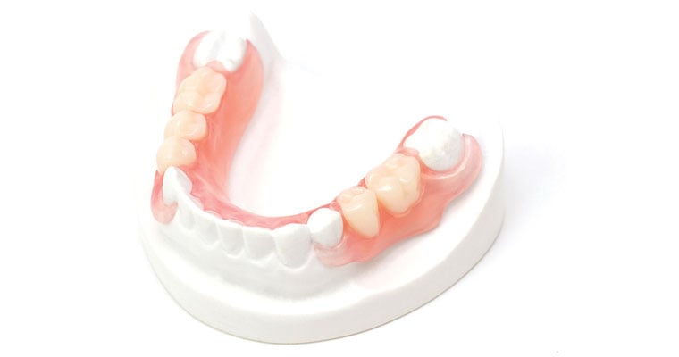 Lower Valplast Flexible partial | QualityDentalLab