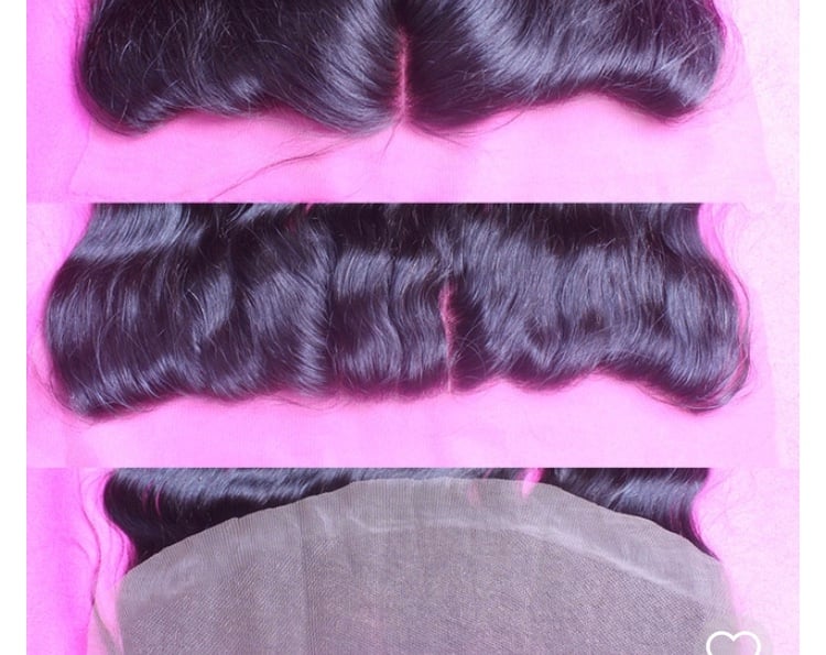 Image of Frontals 