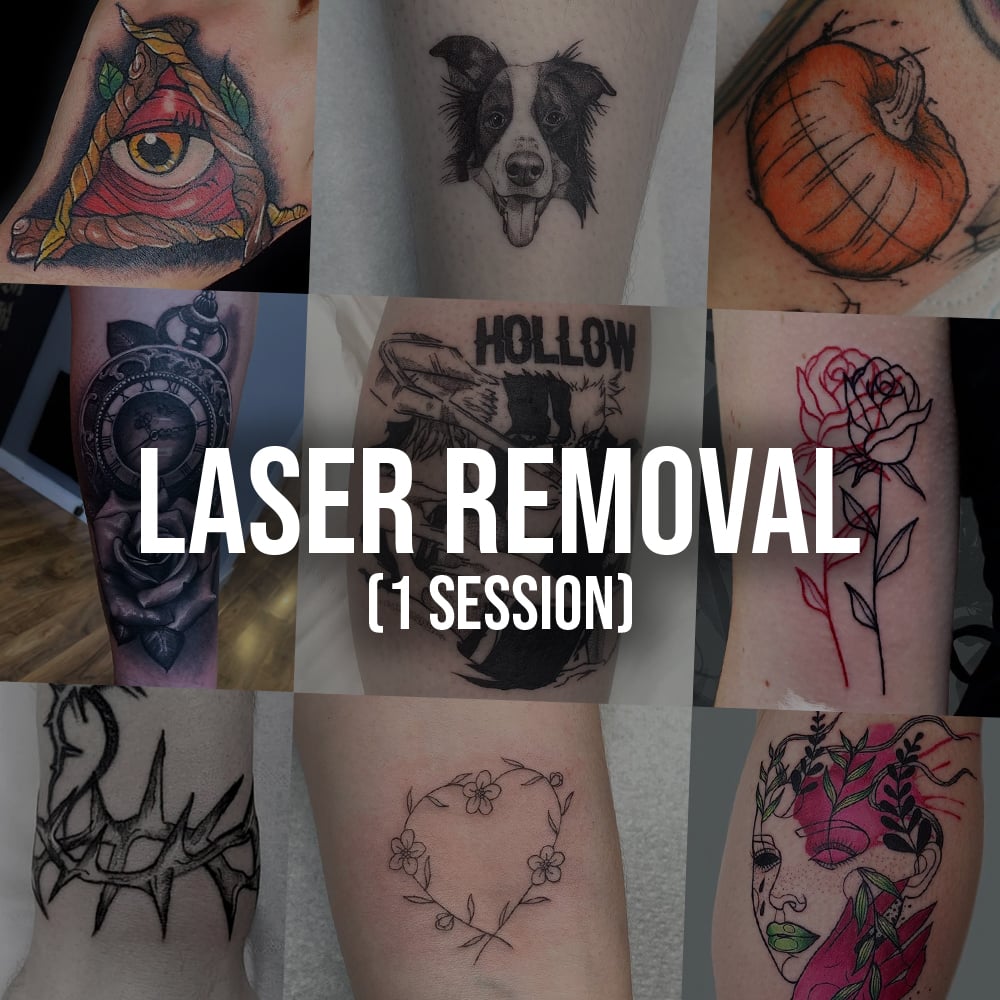Laser Removal (1 Session) | The Studio