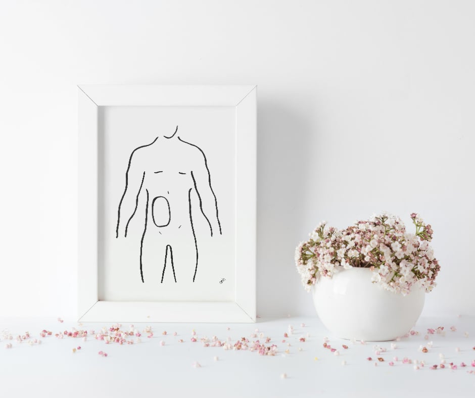 Male Ostomate outline body print