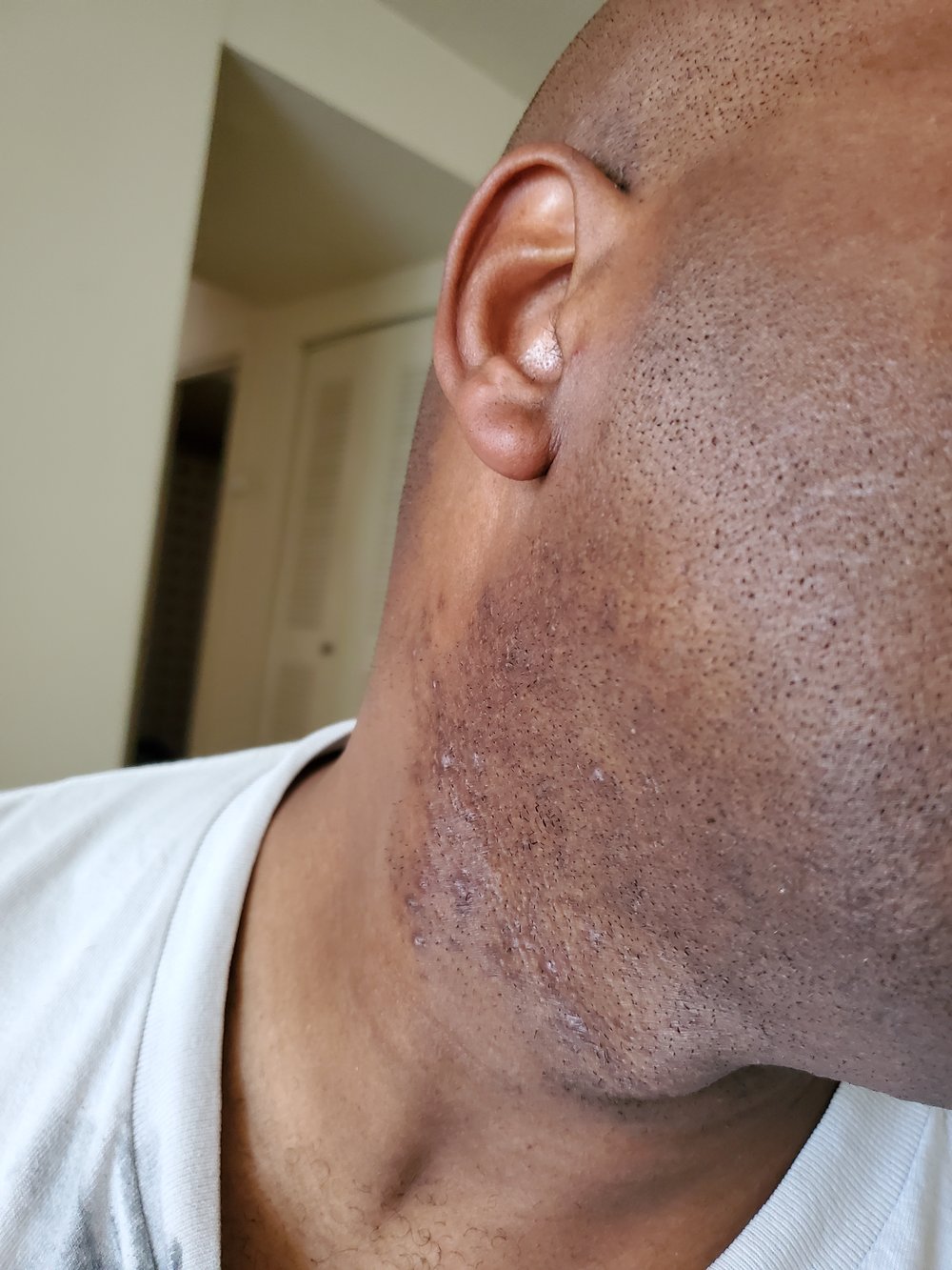 Image of Aloe Spot Corrector