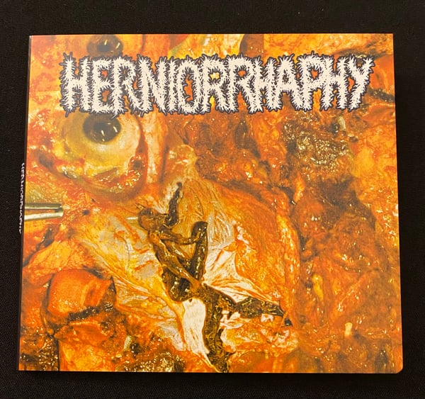 Image of Herniorrhaphy- s/t