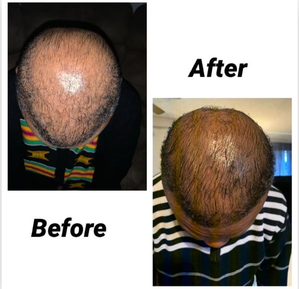 Image of Wonder Hair Growth Drops