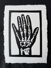 X - Ray