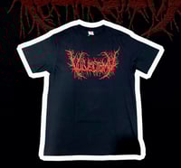 Image 2 of Vulvectomy (SS/LS)