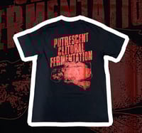 Image 3 of Vulvectomy (SS/LS)