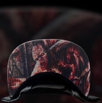 Image 2 of Traumatomy(Snapback)
