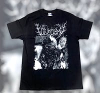 Image 1 of Vulvectomy-Syphilic Dismembered Slut