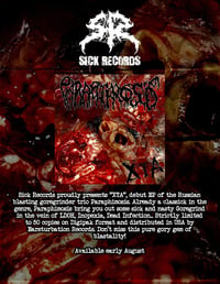 Paraphimosis-xta Cd 