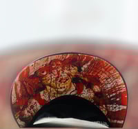 Image 3 of Viscera Infest-Verrucous Carcinoma