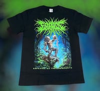 Image 2 of Esophagus (SS/LS)