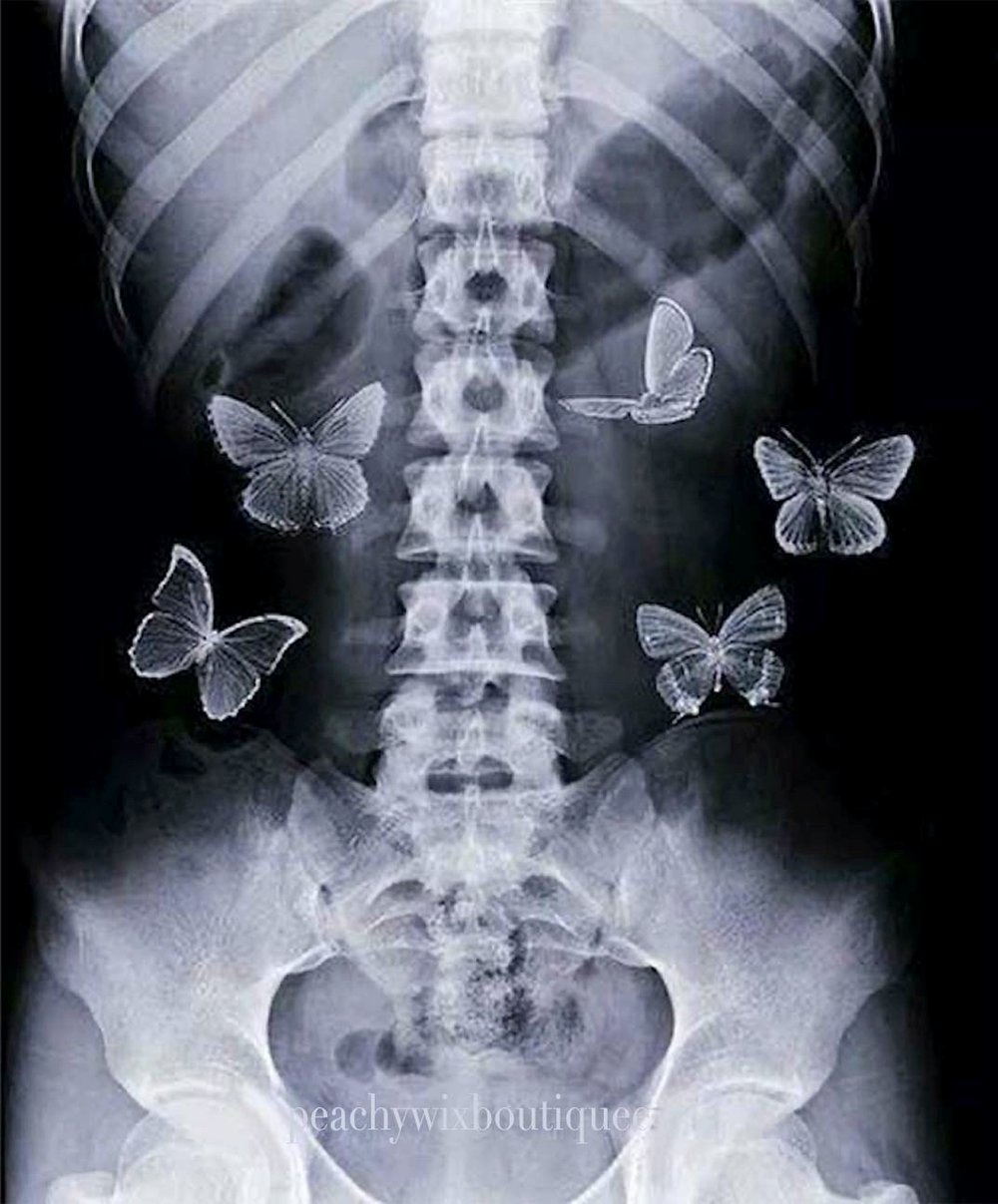Image of Butterflies in My Stomach