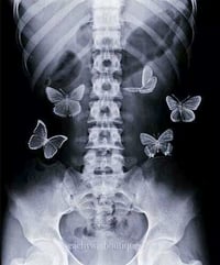 Image 4 of Butterflies in My Stomach