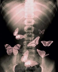 Image 3 of Butterflies in My Stomach