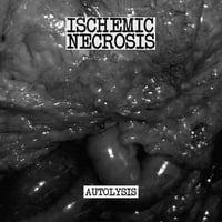 Image 2 of Ischemic Necrosis-autolysis cd