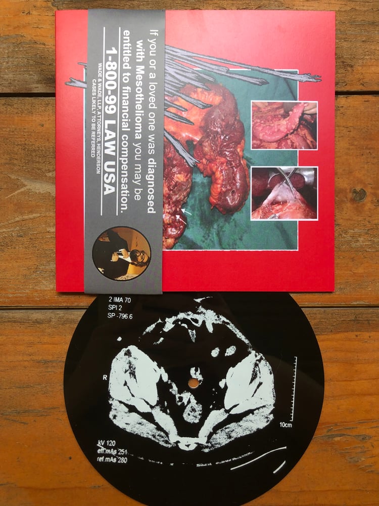 Image of Mesothelioma - Untitled 7"